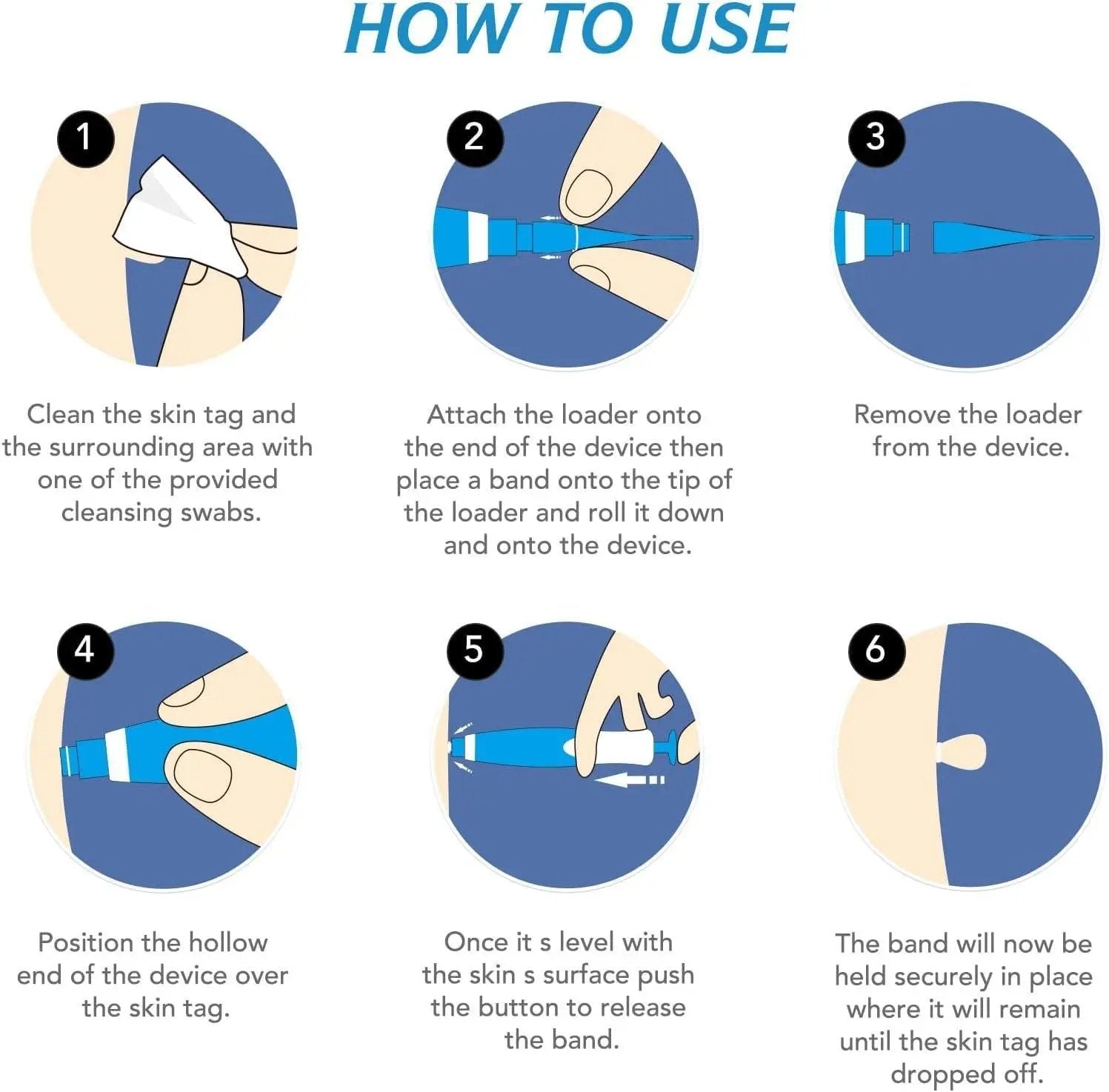 2 in 1 Skin Tag Remover Kit - Painless 9ttgn1-6x